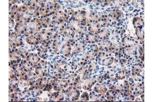 Immunohistochemistry (IHC) image for anti-Aryl Hydrocarbon Receptor Interacting Protein-Like 1 (AIPL1) antibody (ABIN1496508) (AIPL1 抗体)