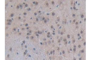 Detection of EP300 in Mouse Brain Tissue using Polyclonal Antibody to E1A Binding Protein P300 (EP300) (p300 抗体  (AA 2124-2397))