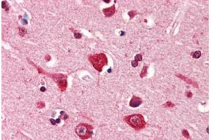 Human Brain, Cortex (formalin-fixed, paraffin-embedded) stained with PDPN antibody ABIN364350 at 5 ug/ml followed by biotinylated anti-mouse IgG secondary antibody ABIN481714, alkaline phosphatase-streptavidin and chromogen. (Podoplanin 抗体  (AA 1-206))