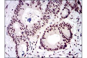 Immunohistochemistry (IHC) image for anti-Catenin, beta Like 1 (CTNNBL1) (AA 390-557) antibody (ABIN2682986)
