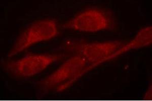 Immunofluorescence staining of methanol-fixed Hela cells using Shc1(Phospho-Tyr427) Antibody. (SHC1 抗体  (pTyr427))