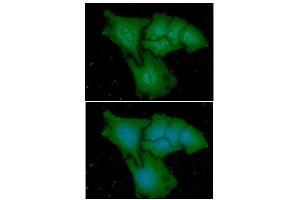 ICC/IF analysis of CAPG in HeLa cells line, stained with DAPI (Blue) for nucleus staining and monoclonal anti-human CAPG antibody (1:100) with goat anti-mouse IgG-Alexa fluor 488 conjugate (Green). (CAPG 抗体  (AA 1-348))