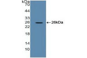 Western blot analysis of recombinant Human EEF2. (EEF2 抗体  (AA 32-233))