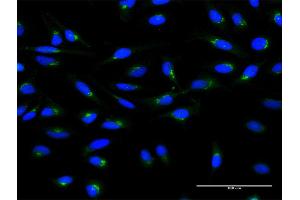 Immunofluorescence of monoclonal antibody to ARF1 on HeLa cell.
