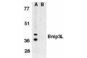 Western blot analysis of Bnip3L in K562 whole cell lysate in the absence (A), or presence (B) of immunogenic peptide with Bnip3L antibody at 1μg/ml. (BNIP3L/NIX 抗体  (AA 77-92))