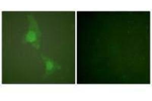 Immunofluorescence analysis of HeLa cells, using ADD1 (Ab-726) antibody