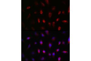 anti-Guanine Nucleotide Binding Protein (G Protein), beta Polypeptide 3 (GNB3) (AA 1-230) antibody