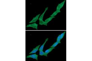 ICC/IF analysis of CD73 in HeLa cells. (CD73 抗体)