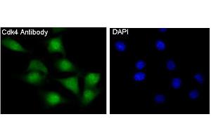 Immunofluorescence (IF) image for anti-Cyclin-Dependent Kinase 4 (CDK4) antibody (ABIN7606918)