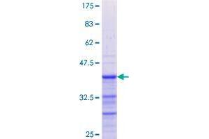 Image no. 1 for Gremlin 1 (GREM1) (AA 25-124) protein (GST tag) (ABIN1355712)