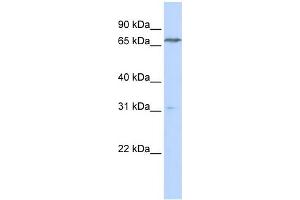 WB Suggested Anti-PCCA Antibody Titration:  0. (PCCA 抗体  (N-Term))
