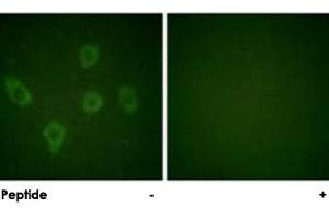Immunofluorescence analysis of HUVEC cells, using CASP9 polyclonal antibody . (Caspase 9 抗体)