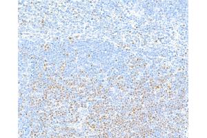 Immunohistochemistry (IHC) image for anti-Transcription Factor 7 (T-Cell Specific, HMG-Box) (TCF7) (AA 200-250) antibody (ABIN7449420) (Recombinant TCF7 抗体  (AA 200-250))