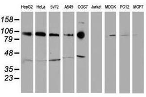 Image no. 1 for anti-Cadherin 2 (CDH2) antibody (ABIN1499626) (N-Cadherin 抗体)
