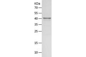 Western Blotting (WB) image for 2',5'-Oligoadenylate Synthetase 1, 40/46kDa (OAS1) (AA 1-364) protein (His tag) (ABIN7121603) (OAS1 Protein (AA 1-364) (His tag))