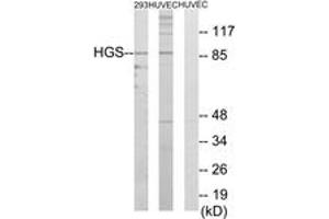 Western blot analysis of extracts from 293/HuvEc cells, using HGS Antibody. (HGS 抗体  (AA 451-500))