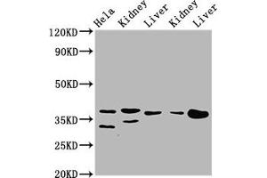 Western Blot Positive WB detected in: Hela whole cell lysate, Rat kidney tissue, Rat liver tissue, Mouse kidney tissue, Mouse liver tissue All lanes: PPA2 antibody at 3. (PPA2 抗体  (AA 180-298))