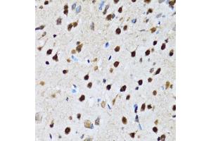 Immunohistochemistry of paraffin-embedded rat brain using CCAR2 antibody (ABIN2563550) at dilution of 1:100 (40x lens). (CCAR2 抗体)