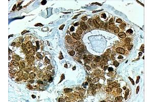 Immunohistochemistry (IHC) image for anti-Cytochrome P450, Family 7, Subfamily B, Polypeptide 1 (CYP7B1) (C-Term) antibody (ABIN185122)