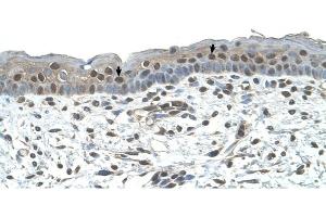 Immunohistochemistry (IHC) image for anti-Nuclear Receptor Subfamily 2, Group C, Member 2 (NR2C2) (C-Term) antibody (ABIN630120)