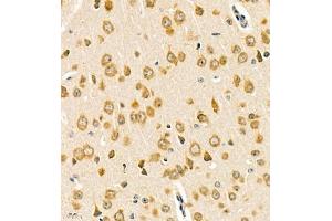 Immunohistochemistry (Paraffin-embedded Sections) (IHC (p)) image for anti-Ras-Related C3 Botulinum Toxin Substrate 3 (Rho Family, Small GTP Binding Protein Rac3) (RAC3) antibody (ABIN7075378)