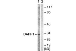 Western Blotting (WB) image for anti-Dual Adaptor of Phosphotyrosine and 3-phosphoinositides (DAPP1) (AA 105-154) antibody (ABIN2888819) (DAPP1 抗体  (AA 105-154))