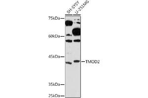 Western blot analysis of extracts of various cell lines, using TMOD2 Rabbit mAb (ABIN7271011) at 1:1000 dilution. (TMOD2 抗体)