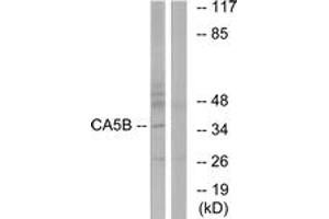 Western blot analysis of extracts from NIH-3T3 cells, using CA5B Antibody.