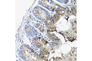 Immunohistochemistry of paraffin-embedded mouse jejunum using  antibody (ABIN6127437, ABIN6136922, ABIN6136923 and ABIN6217829) at dilution of 1:50 (40x lens). (Annexin A13 抗体  (AA 1-316))