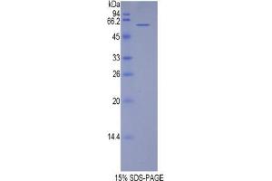 SDS-PAGE analysis of Human TERF1 Protein. (TRF1 蛋白)