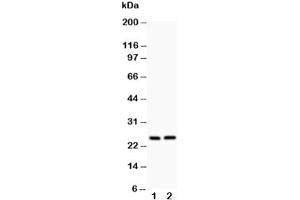 Western blot testing of Claudin 2 antibody and Lane 1:  rat kidney (Claudin 2 抗体  (AA 38-230))