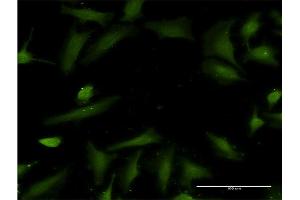 Immunofluorescence of monoclonal antibody to HTN3 on HeLa cell. (HTN3 抗体  (AA 1-51))