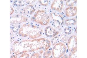Used in DAB staining on fromalin fixed paraffin- embedded kidney tissue (MAPK13 抗体  (AA 1-365))