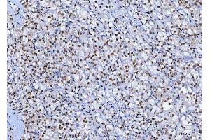 IHC analysis of SP1 using anti-SP1 antibody (ABIN7601559). (SP1 抗体  (AA 384-603))