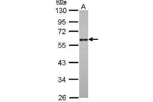 WB Image Sample (30 ug of whole cell lysate) A: A431 10% SDS PAGE antibody diluted at 1:2000 (CDC25C 抗体)