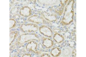 Immunohistochemistry of paraffin-embedded Rat kidney using MT-ND5 Polyclonal Antibody at dilution of 1:100 (40x lens). (MT-ND5 抗体)