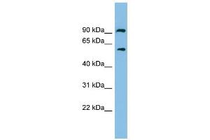 ALDH7A1 antibody used at 1 ug/ml to detect target protein.
