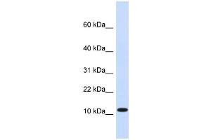 WB Suggested Anti-HMGN1 Antibody Titration:  0. (HMGN1 抗体  (Middle Region))
