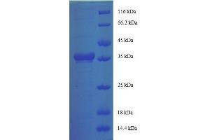 SDS-PAGE (SDS) image for Ribosomal Protein, Large, p1 (RPLP1) (AA 2-114), (full length) protein (GST tag) (ABIN1608003)
