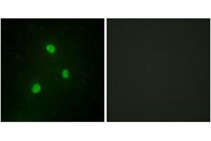 Immunofluorescence analysis of A549 cells, using TBX1 Antibody. (T-Box 1 抗体  (AA 311-360))