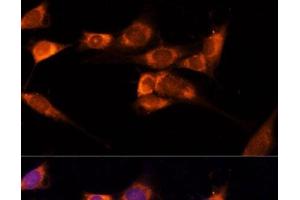Immunofluorescence analysis of NIH-3T3 cells using TXNDC12 Polyclonal Antibody at dilution of 1:100 (40x lens). (TXNDC12 抗体)