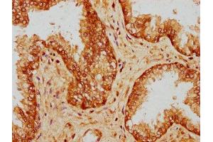 Immunohistochemistry (IHC) image for anti-Protein Phosphatase 5, Catalytic Subunit (PPP5C) (AA 370-488) antibody (ABIN7169288)