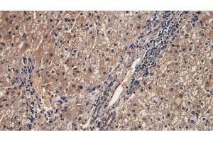 Detection of IFNg in Human Liver Tissue using Monoclonal Antibody to Interferon Gamma (IFNg) (Interferon gamma 抗体  (AA 24-166))