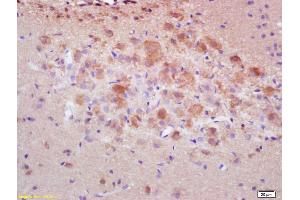 Formalin-fixed and paraffin embedded rat brain labeled with Rabbit Anti pro-caspase-3 Polyclonal Antibody, Unconjugated (ABIN747728) at 1:200 followed by conjugation to the secondary antibody and DAB staining (Caspase 3 抗体  (AA 11-120))