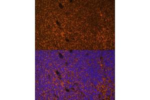 Immunofluorescence analysis of mouse embryos cells using PTCH1 antibody (ABIN1682368, ABIN1682367, ABIN3015342, ABIN3015343 and ABIN6213997) at dilution of 1:100. (Patched 1 抗体  (AA 1214-1312))
