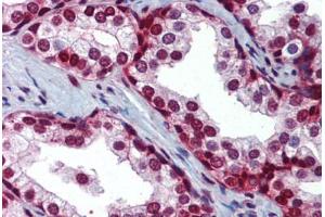 Human Prostate (formalin-fixed, paraffin-embedded) stained with SLC35A5 antibody ABIN462241 followed by biotinylated goat anti-rabbit IgG secondary antibody ABIN481713, alkaline phosphatase-streptavidin and chromogen. (SLC35A5 抗体  (AA 36-85))