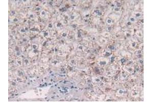 IHC-P analysis of Human Liver Tissue, with DAB staining. (CCL2 抗体  (AA 24-99))