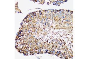 Immunohistochemistry of paraffin-embedded rat testis using IRAK4 antibody. (IRAK4 抗体)