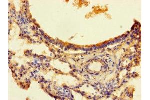 Immunohistochemistry of paraffin-embedded human lung tissue using ABIN7166376 at dilution of 1:100 (ZNF738 抗体  (AA 1-137))