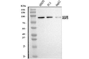 Western blot analysis of AKAP 95/AKAP8 using anti-AKAP 95/AKAP8 antibody (ABIN7601553).